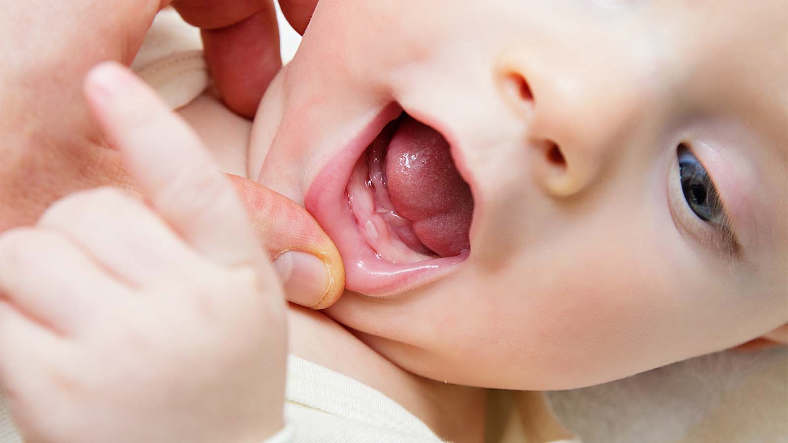 neonatal teeth