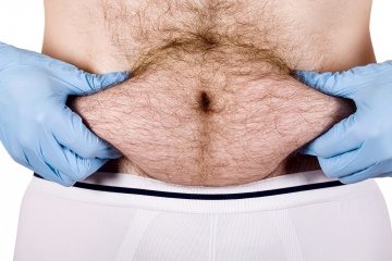 Is What S In My Belly Button Really Lint Howstuffworks