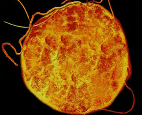 Meet the Energy Superbugs: Extremophiles - Vimarsana News