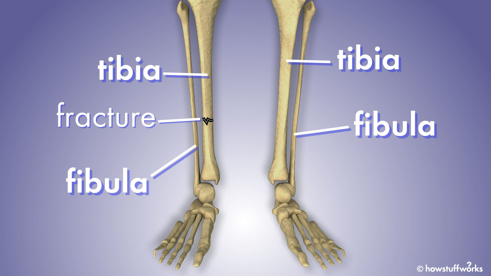 What's the Difference Between the Fibula and Tibia? | HowStuffWorks