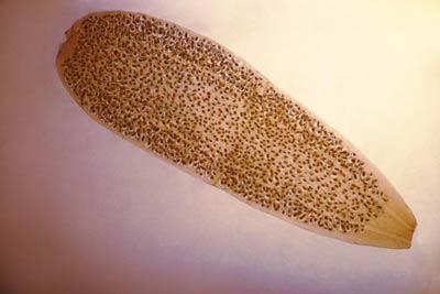A tapeworm segment