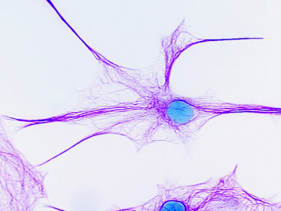 Brain cells are one thing an fMRI can't hone in on.