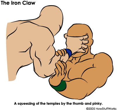 The Iron Claw, or clawhold, was a finishing hold used by old-school Teutonic heels like Baron Von Rothke.