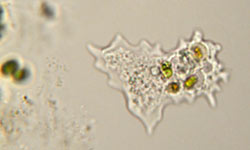Microscopic Parasites >> 5 Rare Parasites Found In The Human Body Howstuffworks Microscopic Parasites >> 5 Rare Parasites Found In The Human Body Howstuffworks