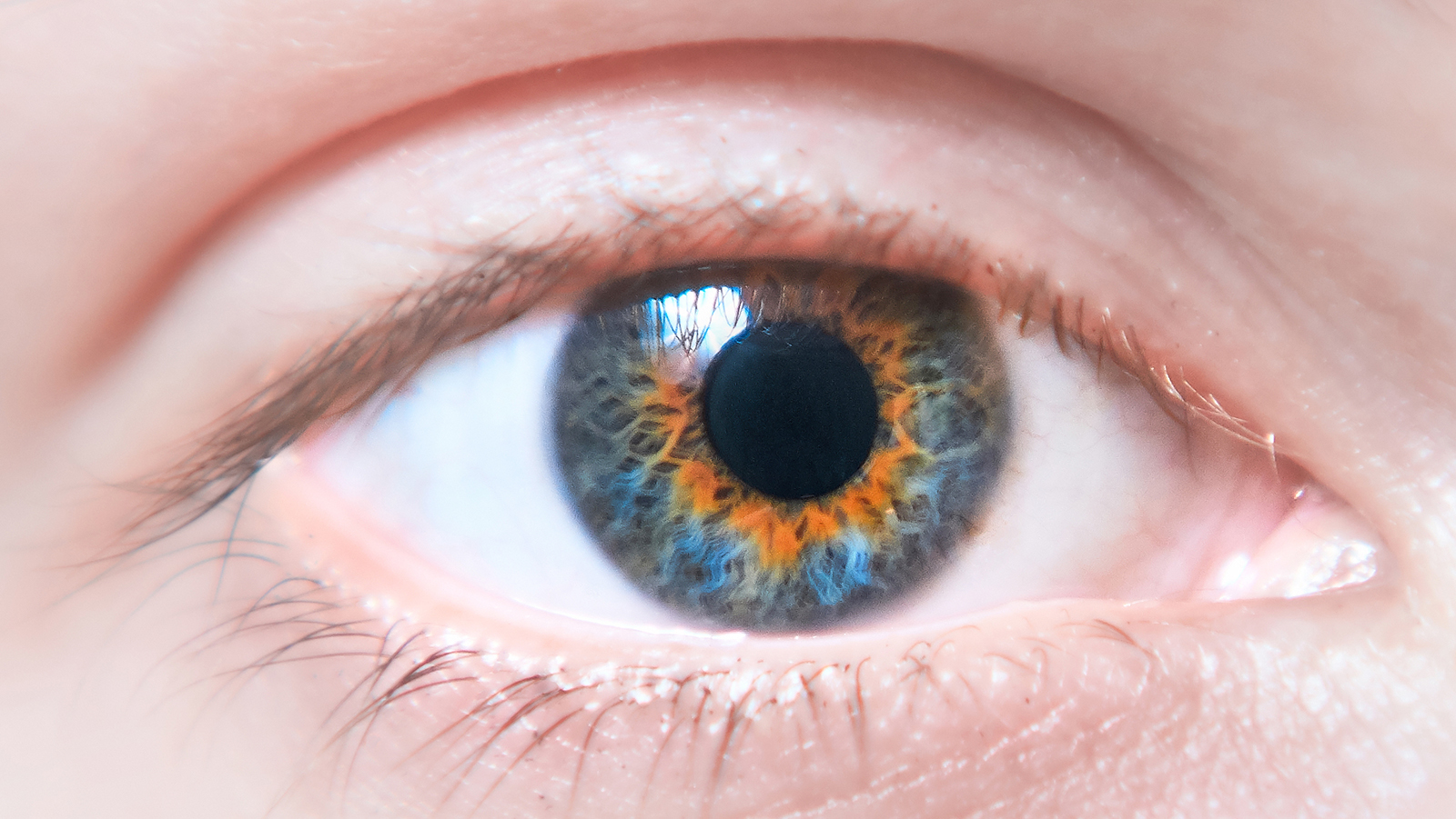 Complete Heterochromia Eye Colors Complete Heterochromia Eye Colors