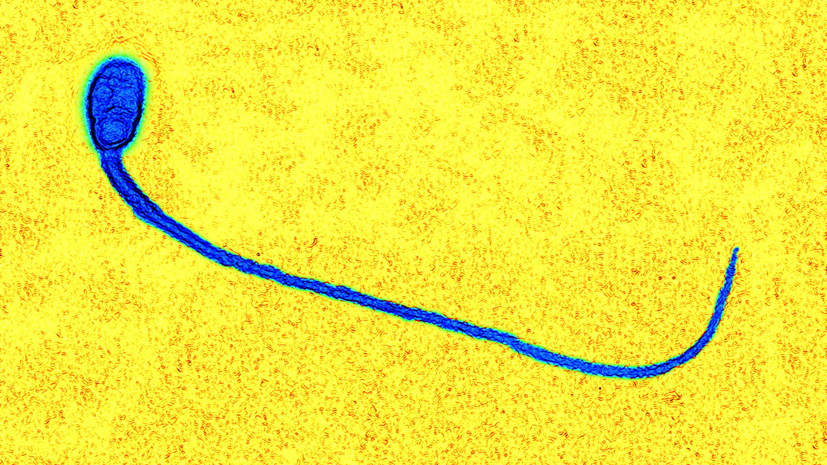 porno-hoy-find-clue-to-curing-sperm-infertility-cells-men-mouyh