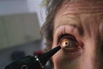 Some speculate that eye problems such as cataracts might be due to a riboflavin deficiency.